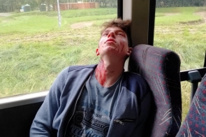 Młody mężczyzna siedzi półprzytomnie na fotelu autobusu, z głową opartą o szybę; twarz i szyja zabrudzone krwią i zadrapaniami, dłonie splecione na kolanach. Za oknem trawa i drzewa.